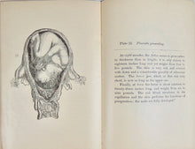 Load image into Gallery viewer, 1887 Wife and Mother, Babies &amp; Children, with plates of Reproductive Organs